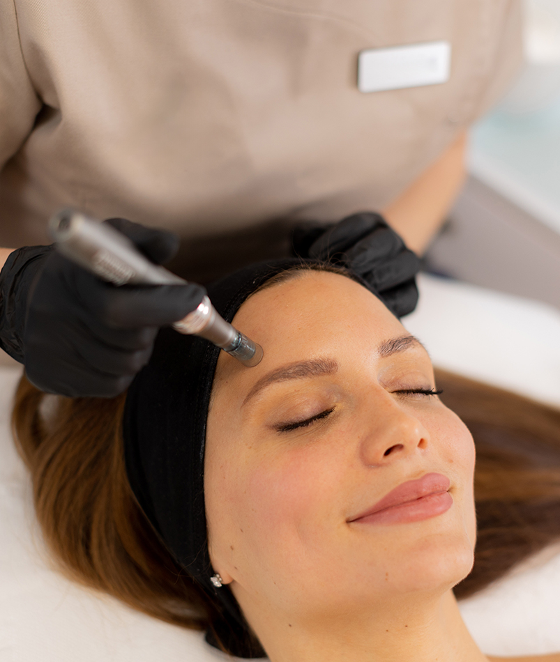 VirtueRF microneedling skin rejuvenation
